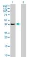 SGT1 Homolog, MIS12 Kinetochore Complex Assembly Cochaperone antibody, H00010910-D01P, Novus Biologicals, Western Blot image 