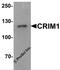 Cysteine Rich Transmembrane BMP Regulator 1 antibody, 6961, ProSci, Western Blot image 