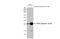 Heat Shock Protein Family B (Small) Member 1 antibody, GTX03197, GeneTex, Western Blot image 