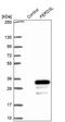 Fer3-like protein antibody, PA5-60389, Invitrogen Antibodies, Western Blot image 