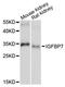 Insulin Like Growth Factor Binding Protein 7 antibody, LS-C748086, Lifespan Biosciences, Western Blot image 