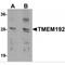 Transmembrane Protein 192 antibody, MBS151517, MyBioSource, Western Blot image 