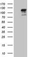 Transforming Growth Factor Beta Receptor 3 antibody, LS-C794862, Lifespan Biosciences, Western Blot image 