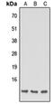 Apolipoprotein C1 antibody, orb235016, Biorbyt, Western Blot image 