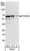Forkhead Box O4 antibody, A302-393A, Bethyl Labs, Western Blot image 