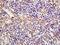 Cellular Retinoic Acid Binding Protein 1 antibody, orb182729, Biorbyt, Immunohistochemistry paraffin image 