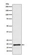 Cofilin 1 antibody, M01525, Boster Biological Technology, Western Blot image 