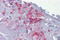 Aspartate Beta-Hydroxylase antibody, ARP34691_P050, Aviva Systems Biology, Immunohistochemistry frozen image 