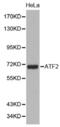 Activating Transcription Factor 2 antibody, abx001767, Abbexa, Western Blot image 