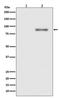 Protein Kinase C Alpha antibody, P00743, Boster Biological Technology, Western Blot image 