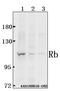 RB Transcriptional Corepressor 1 antibody, A00039S807, Boster Biological Technology, Western Blot image 