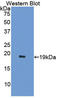 Activin A Receptor Type 2A antibody, LS-C297044, Lifespan Biosciences, Western Blot image 