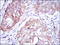 Methylenetetrahydrofolate Reductase antibody, M00336, Boster Biological Technology, Immunohistochemistry frozen image 