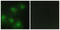 Cyclin Dependent Kinase 2 antibody, LS-C118835, Lifespan Biosciences, Immunofluorescence image 