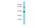 KIAA2013 antibody, A16356, Boster Biological Technology, Western Blot image 