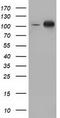 Protein Kinase D2 antibody, CF501672, Origene, Western Blot image 