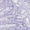 M-Phase Specific PLK1 Interacting Protein antibody, PA5-63573, Invitrogen Antibodies, Immunohistochemistry frozen image 