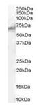 Signal Transducing Adaptor Molecule 2 antibody, orb19203, Biorbyt, Western Blot image 