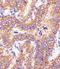 Hydroxysteroid 17-Beta Dehydrogenase 10 antibody, M03844-1, Boster Biological Technology, Immunohistochemistry paraffin image 