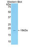 Indoleamine 2,3-Dioxygenase 2 antibody, LS-C294593, Lifespan Biosciences, Western Blot image 