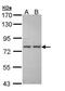 Insulin Like Growth Factor Binding Protein Acid Labile Subunit antibody, PA5-28885, Invitrogen Antibodies, Western Blot image 