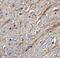 TNF Superfamily Member 12 antibody, A02009-2, Boster Biological Technology, Immunohistochemistry paraffin image 