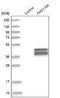 Family With Sequence Similarity 118 Member A antibody, NBP1-88590, Novus Biologicals, Western Blot image 