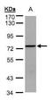 Spleen Associated Tyrosine Kinase antibody, PA5-28574, Invitrogen Antibodies, Western Blot image 