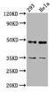 Testin LIM Domain Protein antibody, CSB-PA890679LA01HU, Cusabio, Western Blot image 