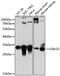 Galectin 3 antibody, GTX35218, GeneTex, Western Blot image 