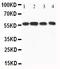 Calcium/Calmodulin Dependent Protein Kinase Kinase 1 antibody, GTX11812, GeneTex, Western Blot image 