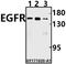 EGFR antibody, A00023T1191, Boster Biological Technology, Western Blot image 