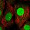 Ubiquitin Conjugating Enzyme E2 M antibody, HPA057800, Atlas Antibodies, Immunofluorescence image 