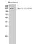 Dynamin 1 antibody, STJ90607, St John