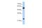Ribosomal Protein L13 antibody, GTX47429, GeneTex, Western Blot image 