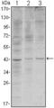 WNT Inhibitory Factor 1 antibody, GTX82765, GeneTex, Western Blot image 