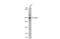 Slit Guidance Ligand 1 antibody, GTX134122, GeneTex, Western Blot image 