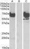 Asparagine Synthetase Domain Containing 1 antibody, 42-435, ProSci, Western Blot image 