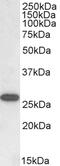 CD2 Cytoplasmic Tail Binding Protein 2 antibody, 45-382, ProSci, Immunohistochemistry frozen image 