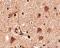 SLIT And NTRK Like Family Member 5 antibody, NBP2-81915, Novus Biologicals, Immunohistochemistry paraffin image 