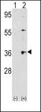 Thrombopoietin antibody, PA5-14494, Invitrogen Antibodies, Western Blot image 