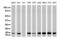 NME/NM23 Nucleoside Diphosphate Kinase 1 antibody, LS-C796838, Lifespan Biosciences, Western Blot image 