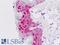 Msh Homeobox 2 antibody, LS-B9066, Lifespan Biosciences, Immunohistochemistry paraffin image 