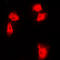 Nuclear Factor Kappa B Subunit 2 antibody, LS-C352571, Lifespan Biosciences, Immunofluorescence image 