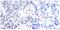 JunB Proto-Oncogene, AP-1 Transcription Factor Subunit antibody, A01825, Boster Biological Technology, Immunohistochemistry paraffin image 