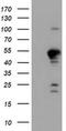 Protein Phosphatase 1 Regulatory Subunit 15A antibody, MA5-25875, Invitrogen Antibodies, Western Blot image 