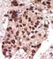 Protein Kinase D3 antibody, GTX25285, GeneTex, Immunohistochemistry paraffin image 