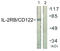 Interleukin 2 Receptor Subunit Beta antibody, abx012830, Abbexa, Western Blot image 