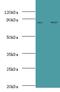 Complement Factor B antibody, LS-B13829, Lifespan Biosciences, Western Blot image 