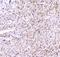 Gap Junction Protein Alpha 1 antibody, PA1026-1, Boster Biological Technology, Immunohistochemistry paraffin image 